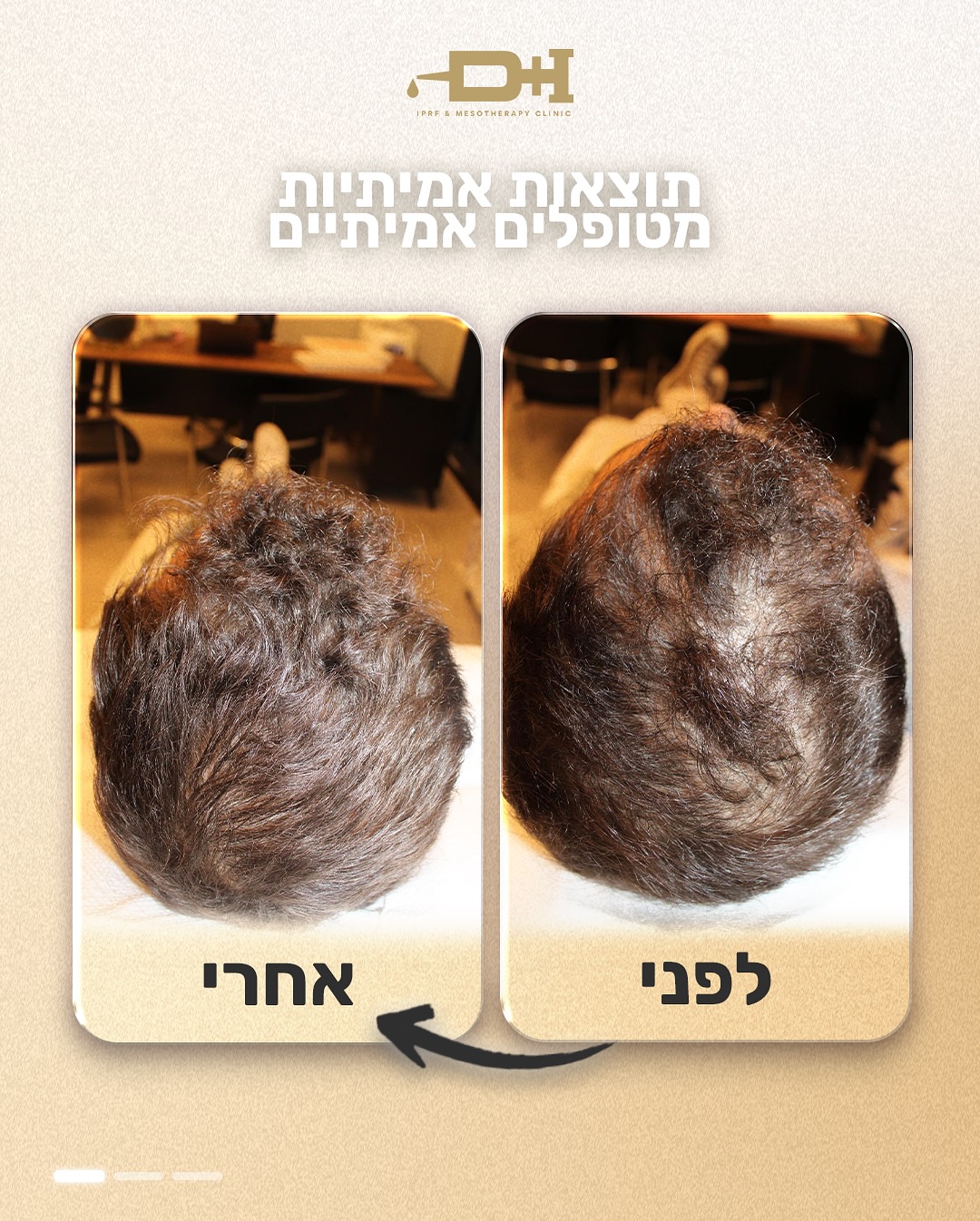 תוצאות לפני ואחרי טיפול 4