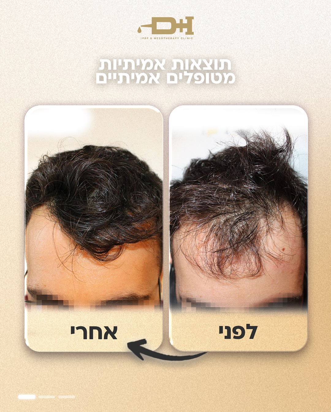 תוצאות לפני ואחרי טיפול 5